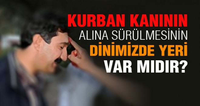 Alna Kan Sürmek