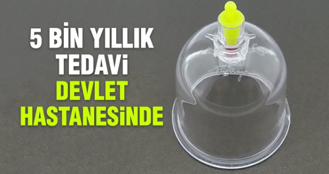 Devlet Hastanelerinde Hacamat Tedavisi