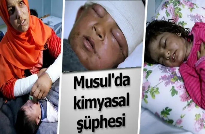 Musul'da kimyasal şüphesi