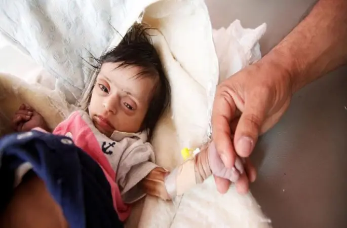 Yemen'de her 10 dakikada bir çocuk, önlenebilir sebeplerden dolayı ölüyor