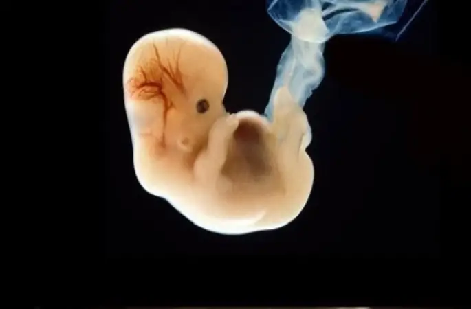 Ruh Bedenin Neresindedir?