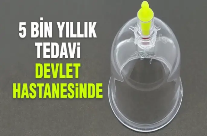 Devlet Hastanelerinde Hacamat Tedavisi