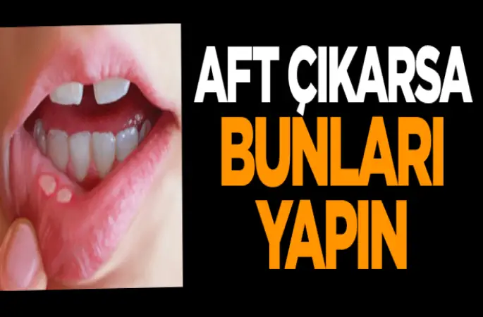 Aft çıkarsa bunları yapın